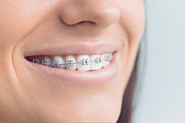 Best Full Mouth Reconstruction  in Fayetteville, NY